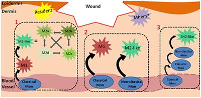 The Role of Macrophages in Acute and Chronic Wound Healing and Interventions to Promote Pro-wound Healing Phenotypes